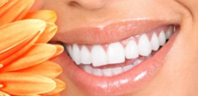 Tẩy trắng răng