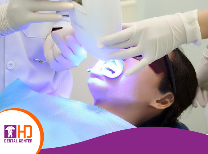 Tẩy trắng răng tại nha khoa uy tín