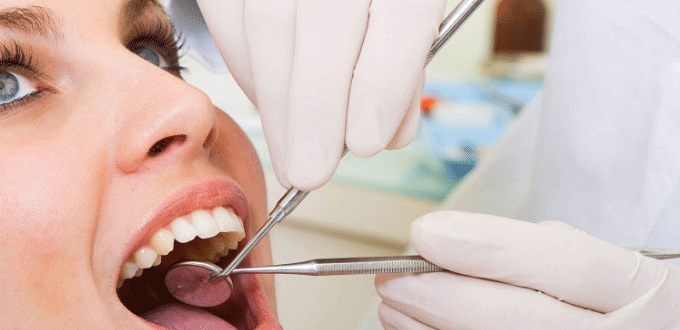 Trám răng sâu sứt mẻ