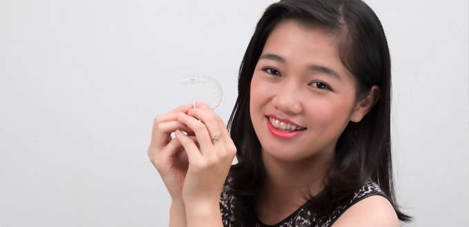 chỉnh nha trong suốt – Invisalign