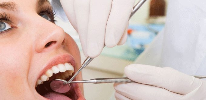 Kết quả hình ảnh cho Kỹ thuật nha khoa trám bít hố rãnh phòng ngừa sâu răng