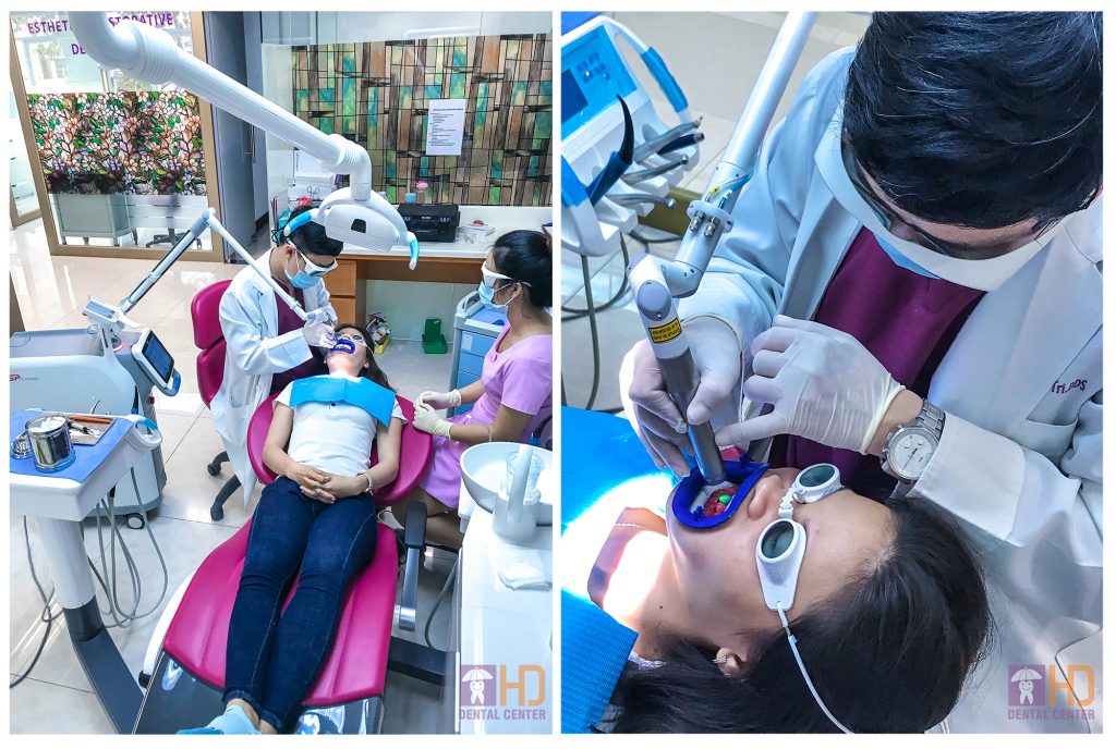Hàm răng trắng sáng tại nha khoa Dr Hùng