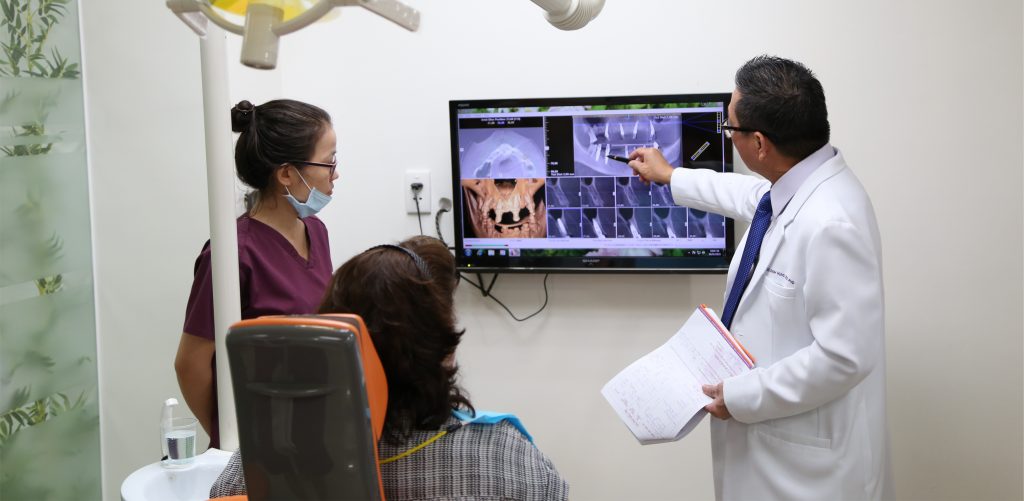 Các thời điểm để đặt implant sau nhổ răng