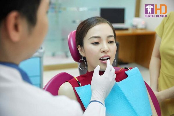 Làm răng trắng bị ố vàng tại Nha khoa Dr Hùng