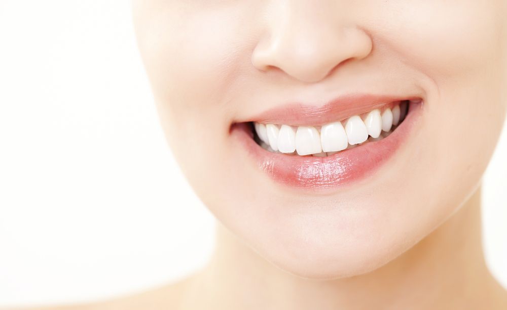 Niềng răng invisalign trả góp giúp khách hàng tiếp cận dịch vụ niềng răng hiện đại